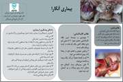 راه های پیشگیری از بیماری آنگارا